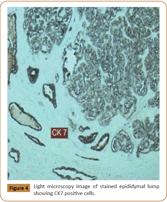 jusurgery-positive-cells