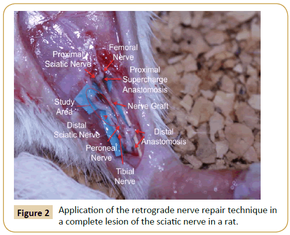 jusurgery-retrograde-nerve