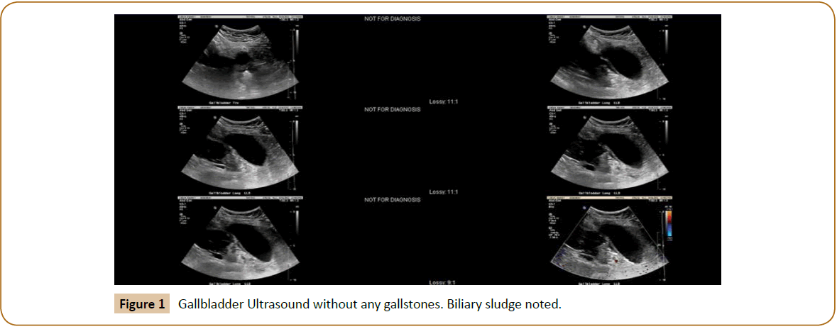 jusurgery-sludge-noted