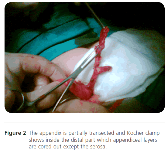 jusurgery-transected