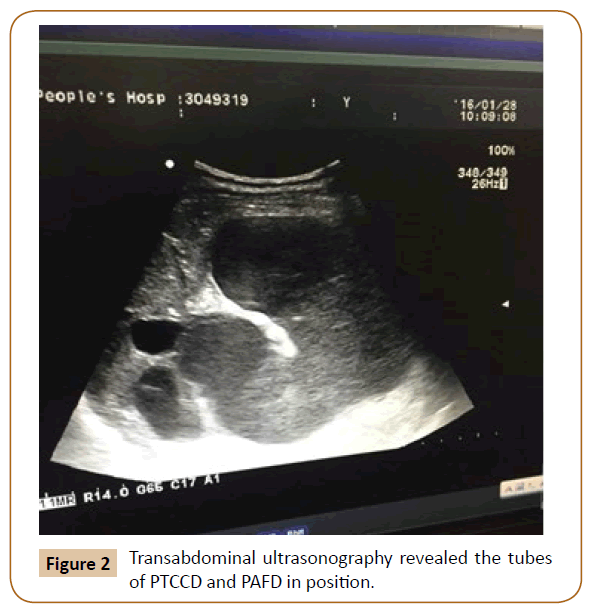 jusurgery-ultrasonography-revealed