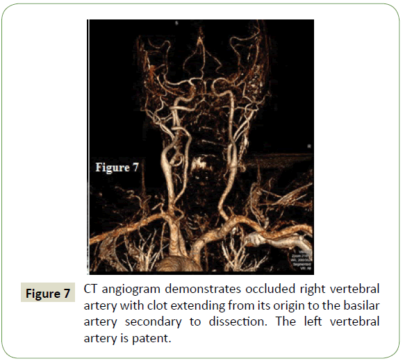 neurology-neuroscience-CT-angiogram