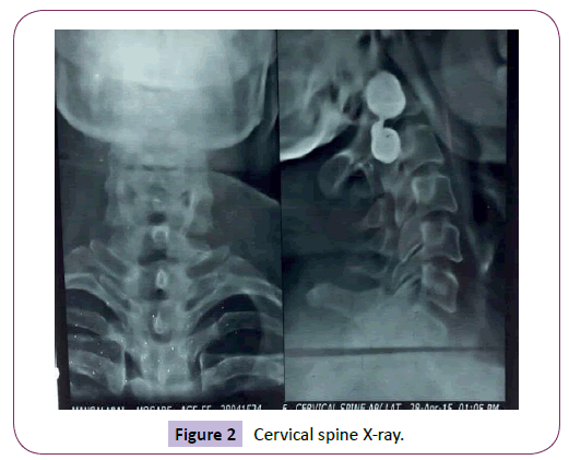 neurology-neuroscience-Cervical-spine