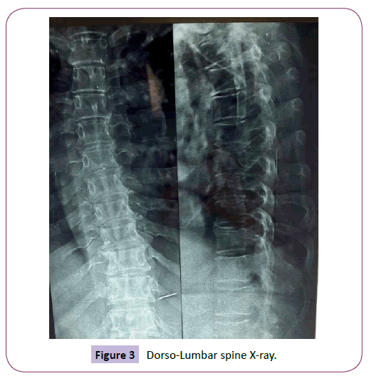 neurology-neuroscience-Dorso-Lumbar