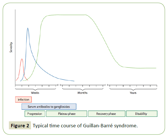 neurology-neuroscience-Guillan-Barre-syndrome-10-4-301-g002