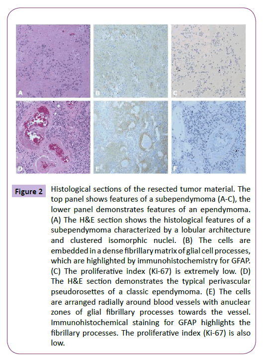 neurology-neuroscience-Histological-sections