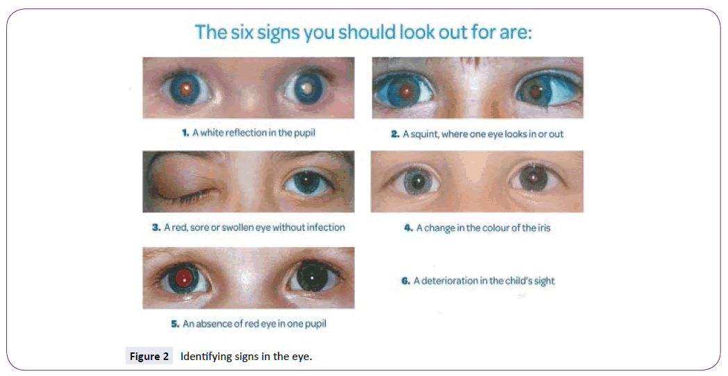 neurology-neuroscience-Identifying-signs