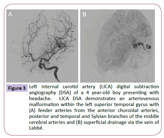 neurology-neuroscience-Left-internal