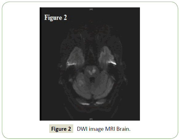 neurology-neuroscience-MRI-Brain
