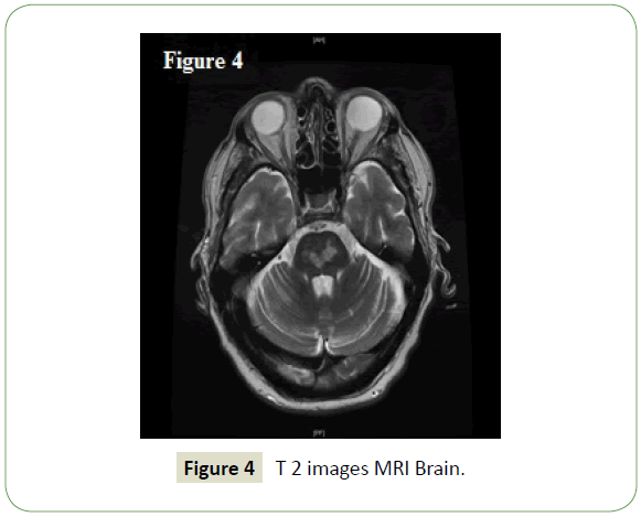 neurology-neuroscience-MRI-Brain