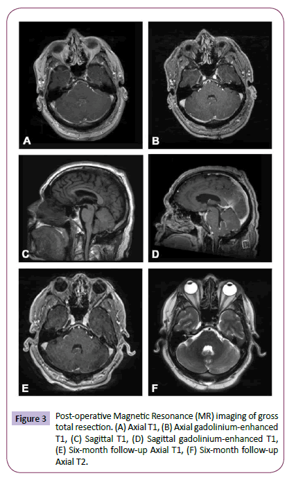 neurology-neuroscience-Magnetic-Resonance