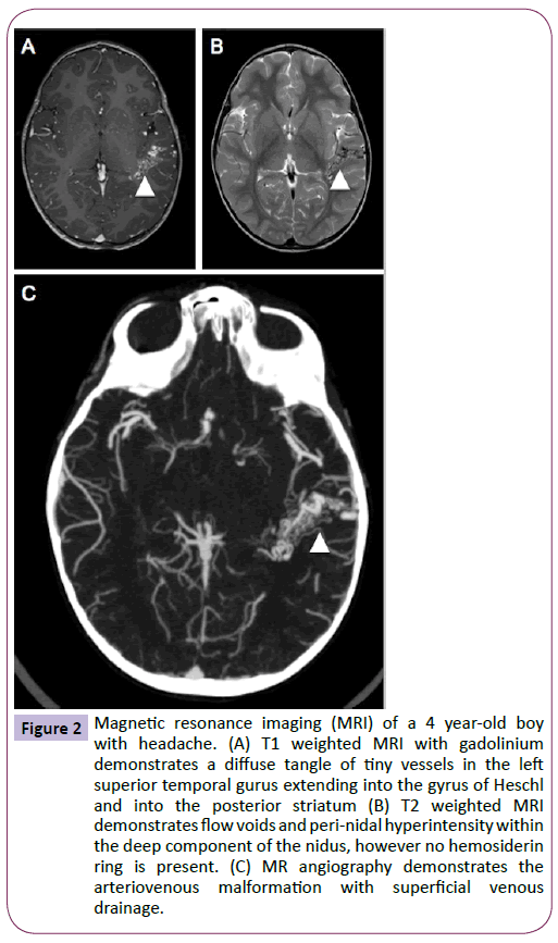 neurology-neuroscience-Magnetic-resonance