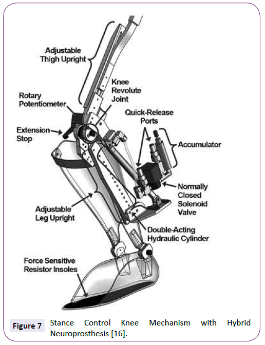 neurology-neuroscience-Mechanism