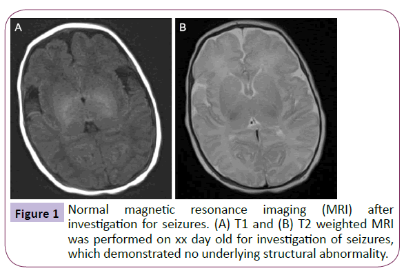 neurology-neuroscience-Normal-magnetic