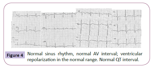 neurology-neuroscience-Normal-sinus