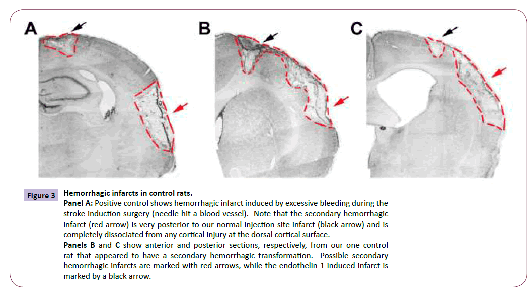 neurology-neuroscience-Positive-control