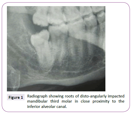 neurology-neuroscience-Radiograph