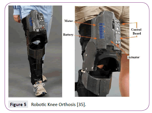 neurology-neuroscience-Robotic-Knee