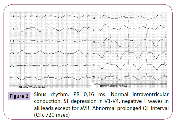 neurology-neuroscience-Sinus-rhythm