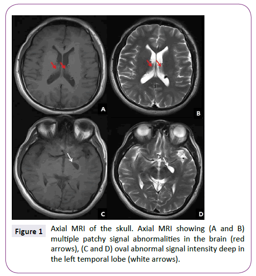 neurology-neuroscience-abnormalities