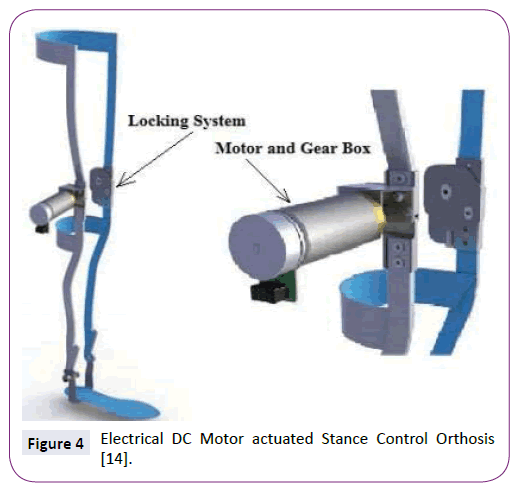 neurology-neuroscience-actuated-Stance