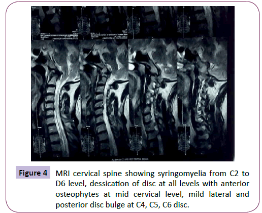 neurology-neuroscience-cervical-spine