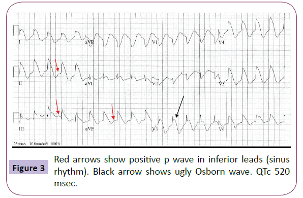 neurology-neuroscience-inferior-leads