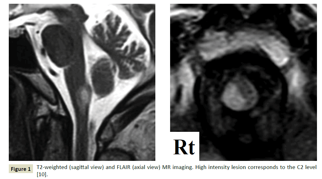  neurology-neuroscience-intensity-lesion