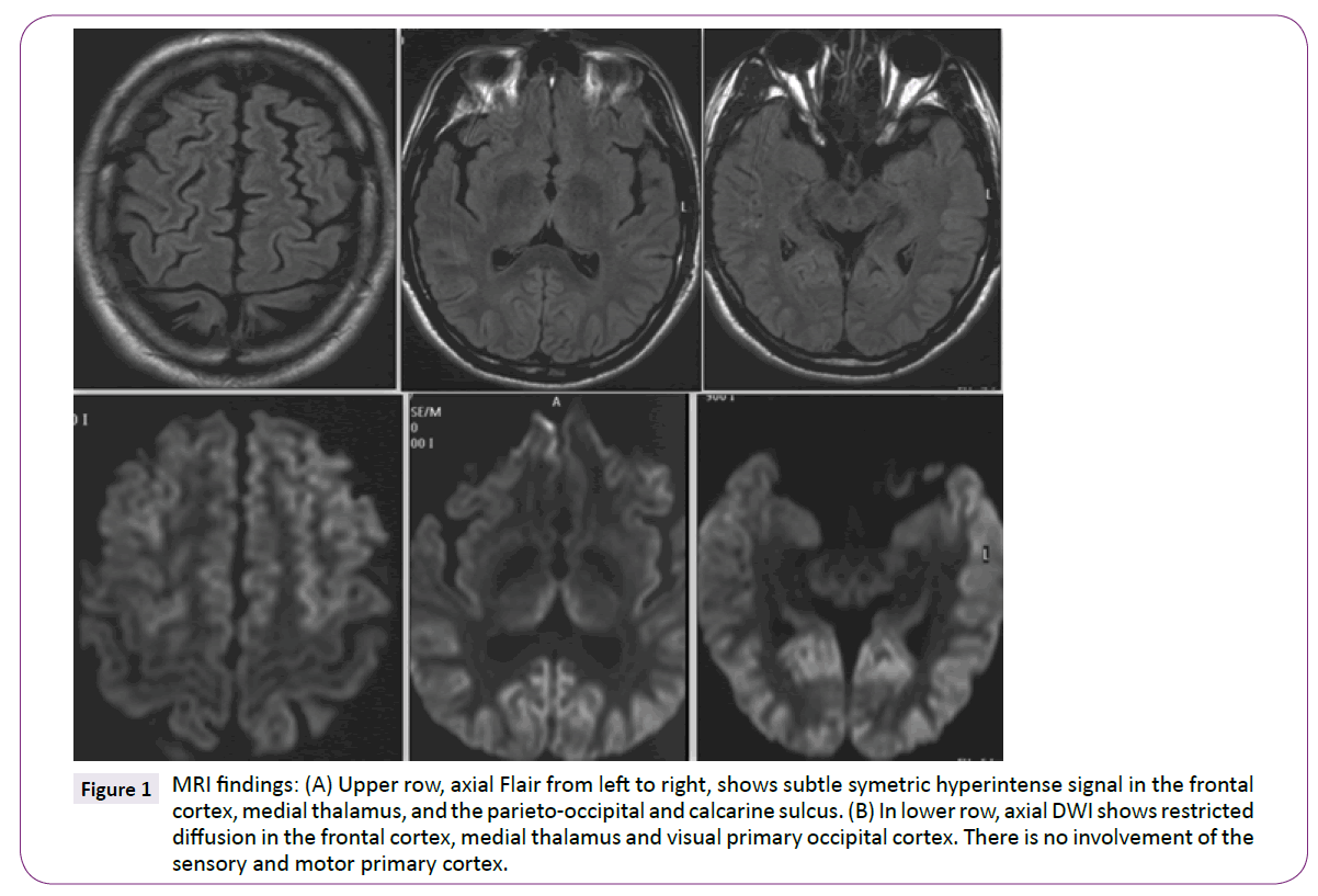 neurology-neuroscience-medial-thalamus