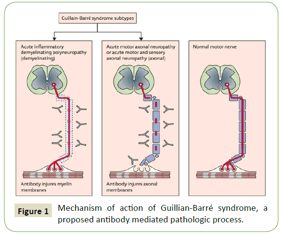 neurology-neuroscience-pathologic-process