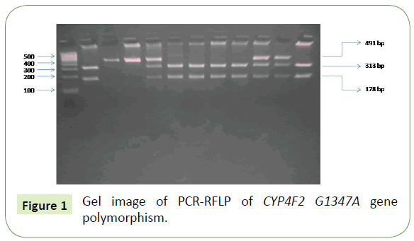 neurology-neuroscience-polymorphism