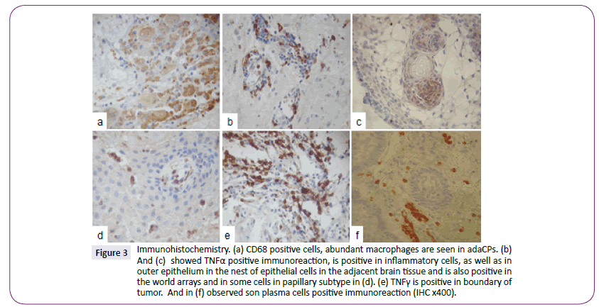 neurology-neuroscience-positive-cells