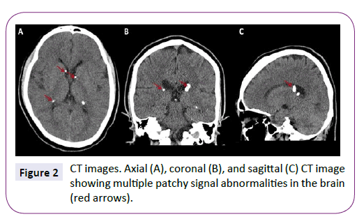 neurology-neuroscience-signal-abnormalities