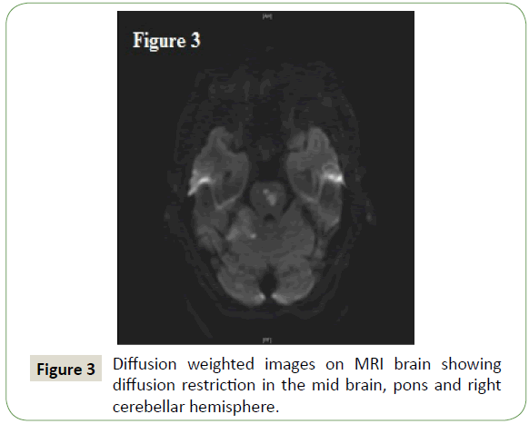 neurology-neuroscience-weighted-images