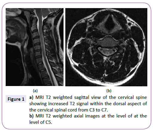 neurology-neuroscience-weighted-sagittal