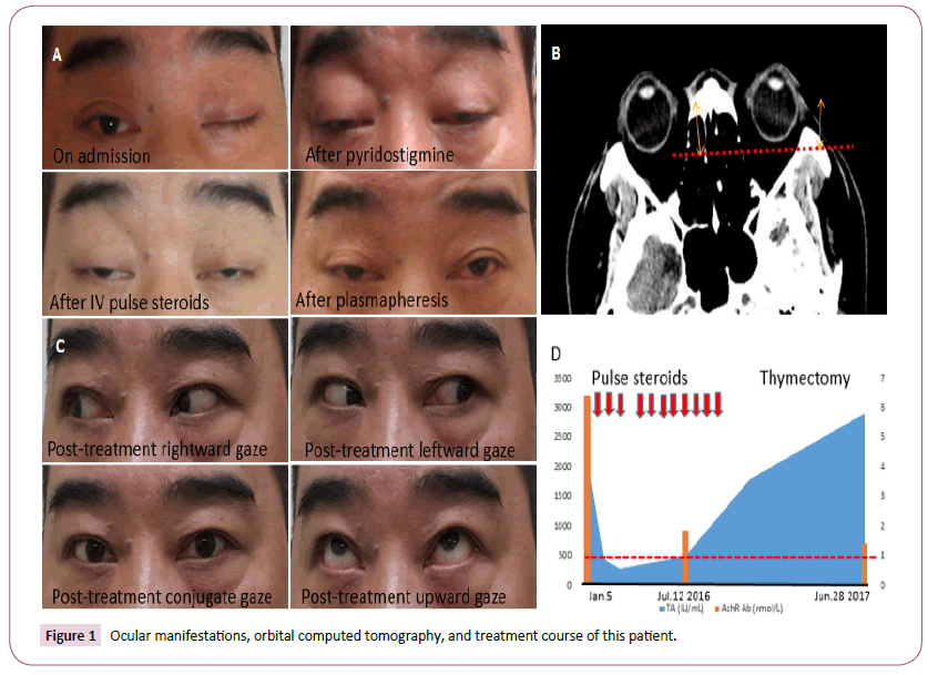 transbiomedicine-tomography