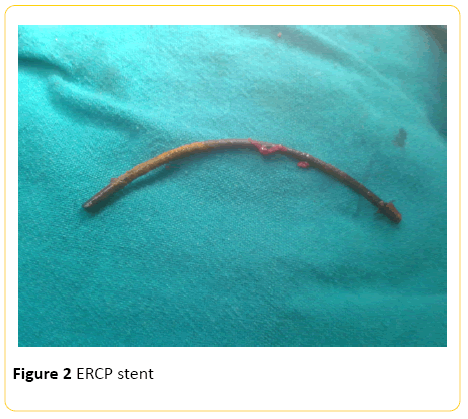 ercp stent