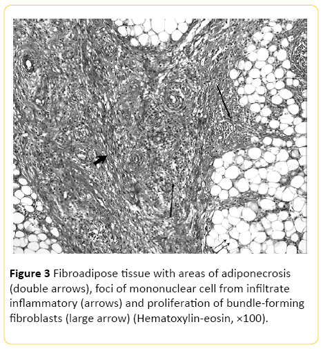 translational-biomedicine-Fibroadipose-tissue