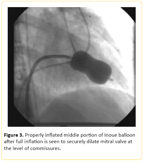 translational-biomedicine-Properly-inflated