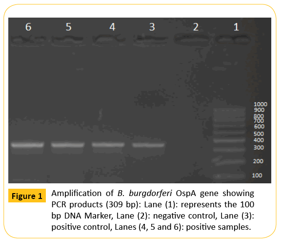 translational-biomedicine-burgdorferi-OspA