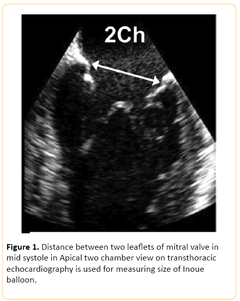 translational-biomedicine-mitral-valve