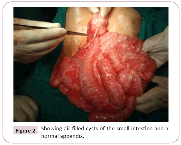 translational-biomedicine-normal-appendix